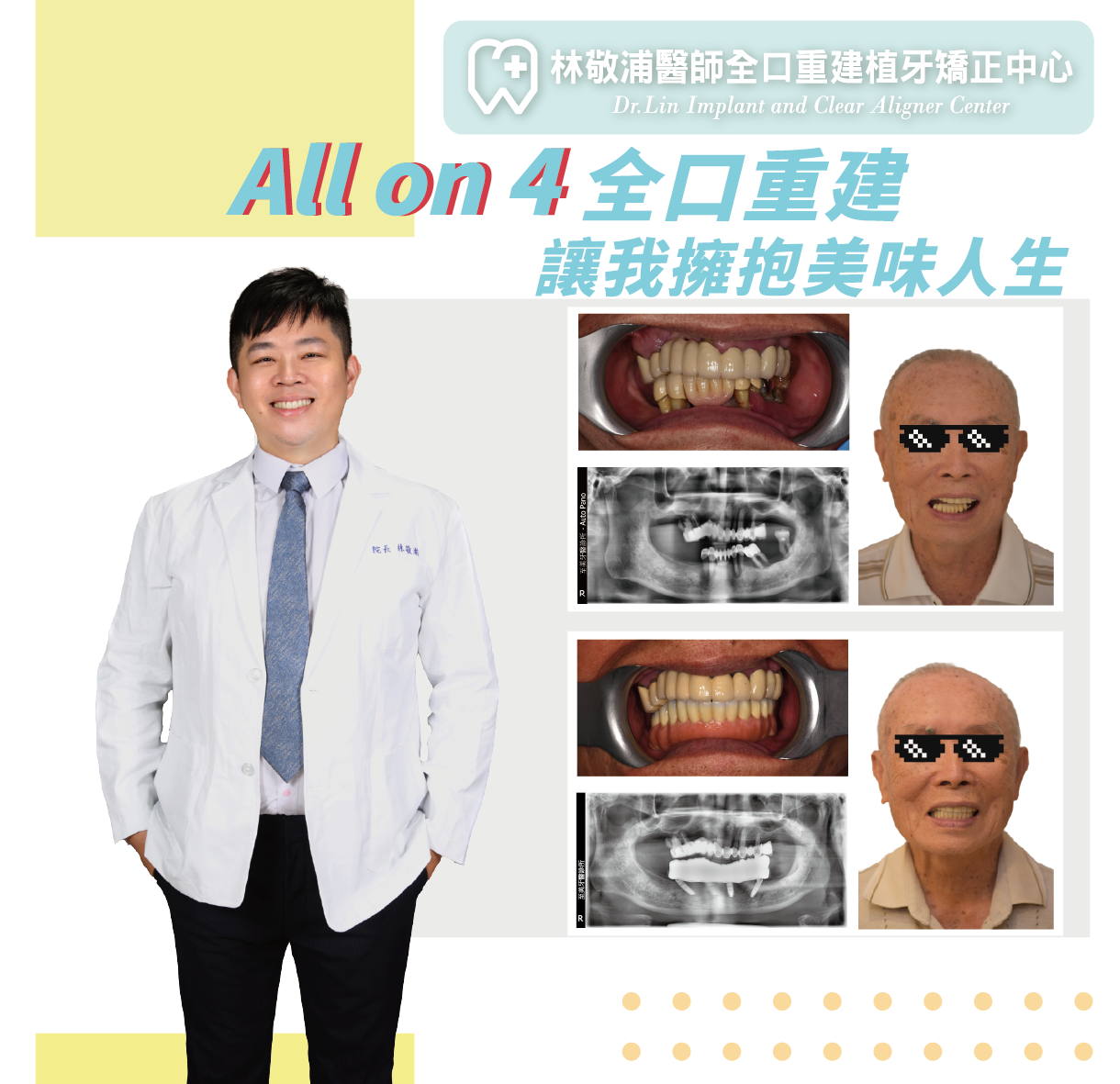 All ON 4｜全口重建