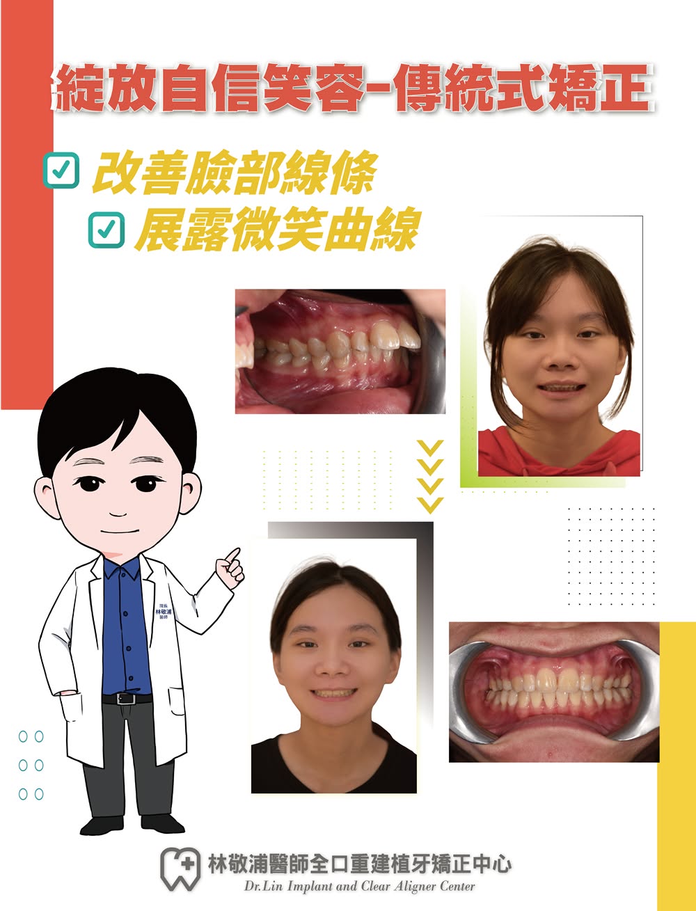 矯正｜改善臉部線條